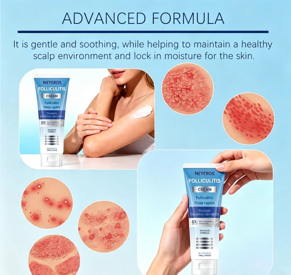 Folliculitis Soothing Cream for Folliculitis Scalp Face and Body✨