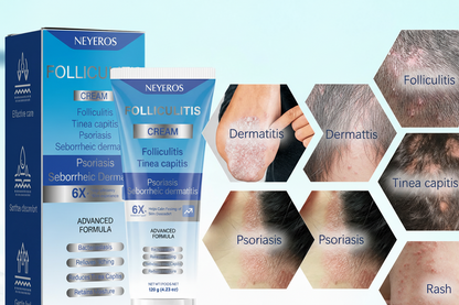 Folliculitis Soothing Cream for Folliculitis Scalp Face and Body✨